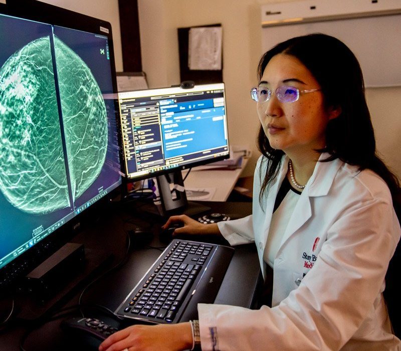 A female doctor in a white lab coat is sitting at a computer workstation, examining digital mammogram images displayed on multiple screens. She wears glasses and is focused on the screens, with a keyboard and mouse visible in front of her.